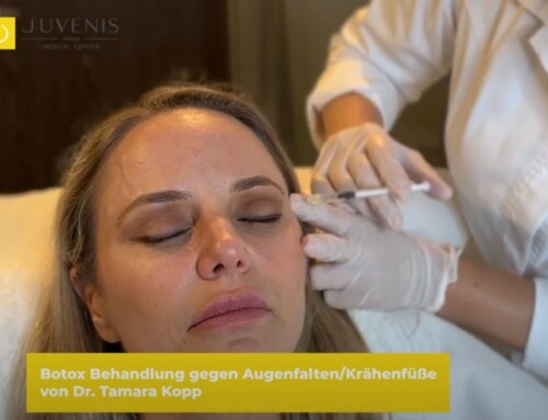 Einblick in eine Botox Behandlung gegen Augenfalten – Krähenfüße