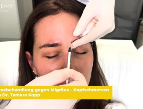 Behandlungsvideo: Botox gegen Migräne – Behandlung von Dr. Tamara Kopp