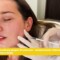 Behandlungsvideo: Botox gegen Bruxismus – Behandlung von Dr. Tamara Kopp